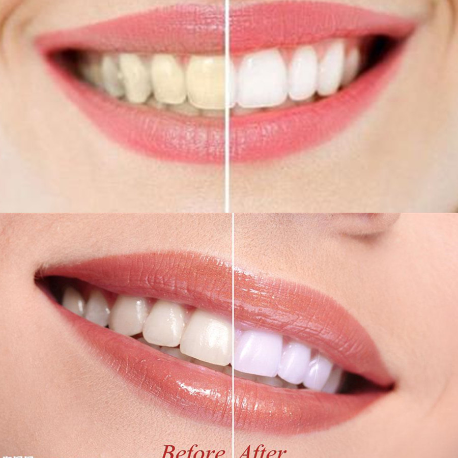 竹炭歯,口腔衛生,煙のホワイトニング,新鮮な呼吸のための歯の - Teeth Whitening Kit のレビューと価格