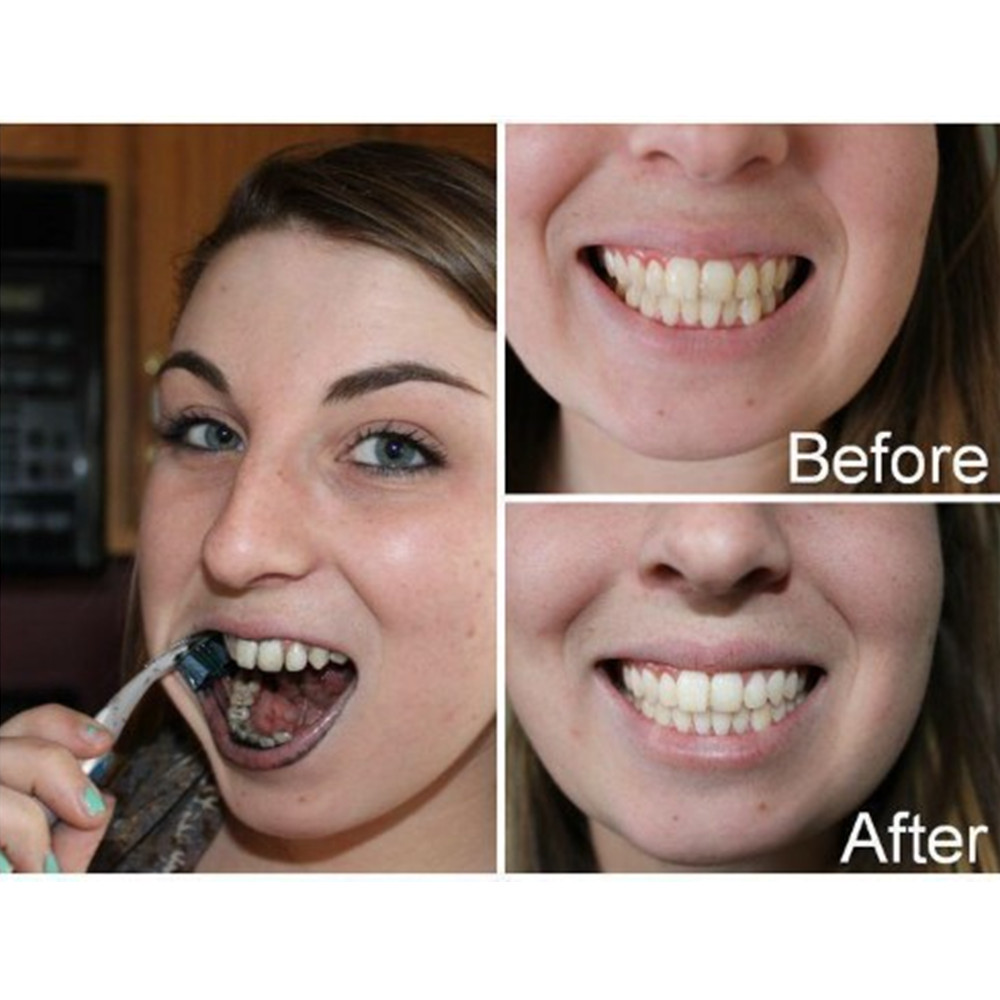 竹炭歯,口腔衛生,煙のホワイトニング,新鮮な呼吸のための歯の - Teeth Whitening Kit のレビューと価格